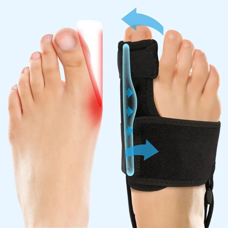 FlexToe™ bunionbrace