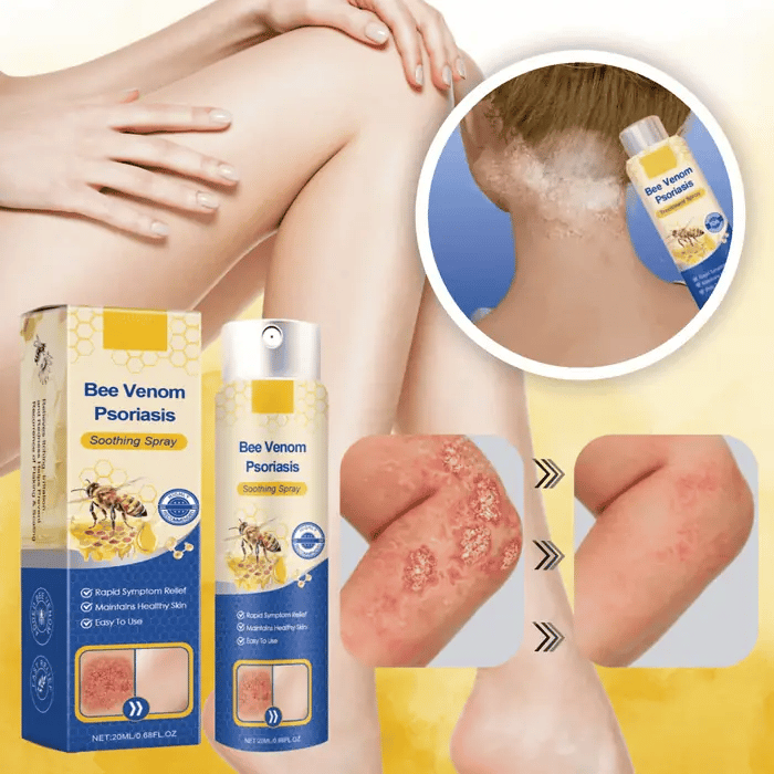 CalmCure™ PsoriaFix Spray