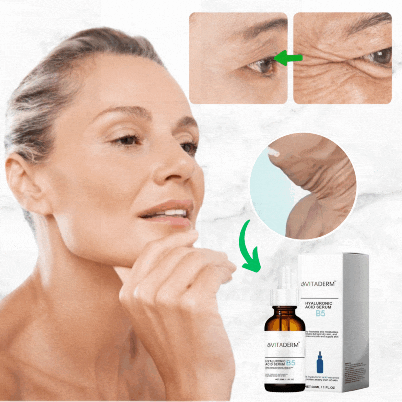VitaDerm™