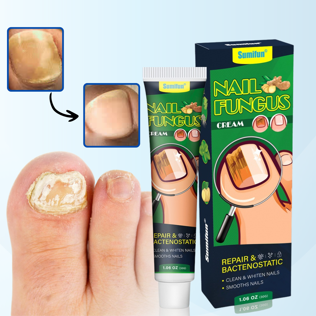 NailFix™ | Verwijdert 93% van nagelschimmel in 3 dagen
