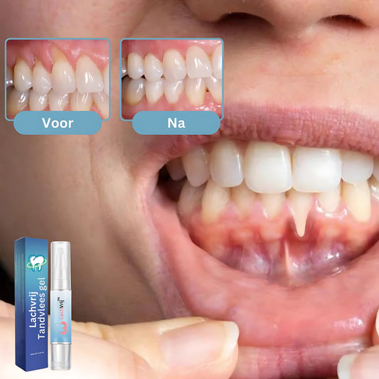 LachVrij™ Gel