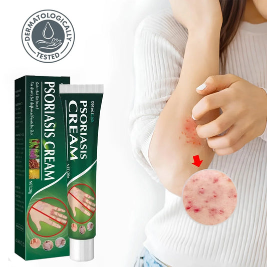 CalmSkin™ Eczeemverlichtende Crème