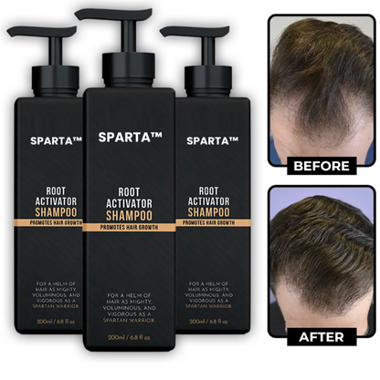 Sparta haaruitval shampoo
