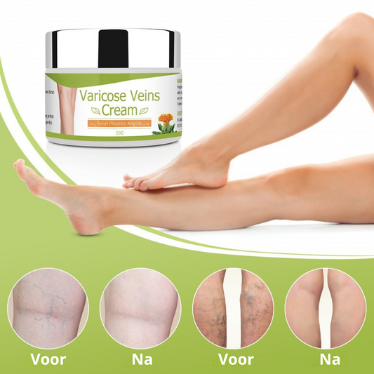 VeinCare™